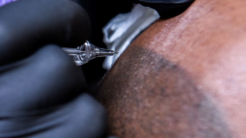 Scalp Micropigmentation: The Hair Restoration Option Nobody Talks About