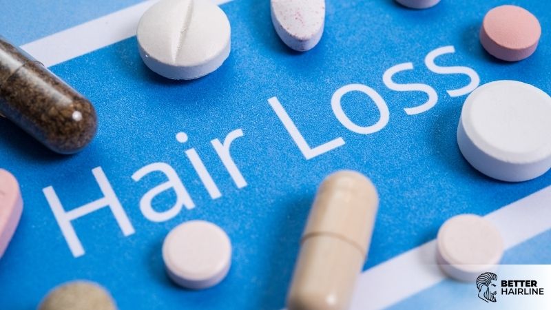 Finasteride and Minoxidil: My Honest Take on Medical Hair Loss Treatments