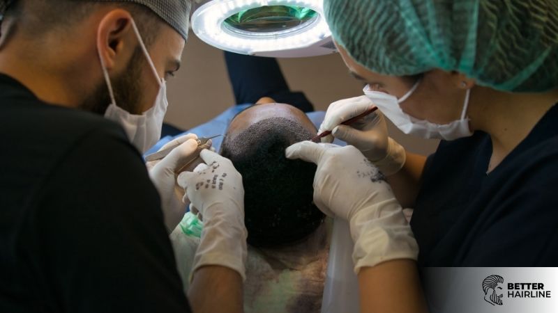 Hair Transplant Costs: A Comparison of Turkey, USA, Canada, and Mexico